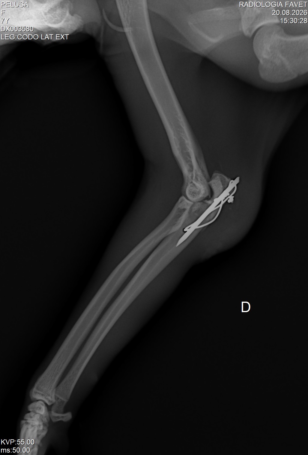 Pelusa Codo Lateral